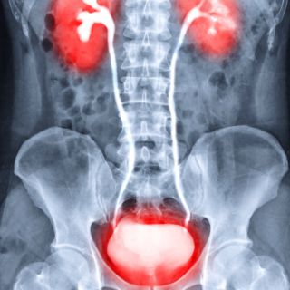 Miglioramento della funzione urinaria